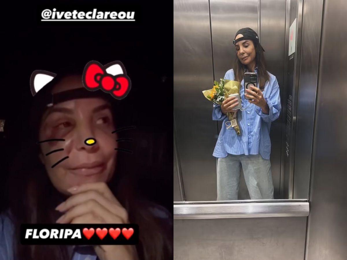 Ivete Sangalo recebe alta após cirurgia no rosto e retorna a Salvador