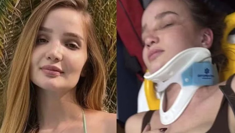 Atriz de 'Chiquititas', Anna Livya Padilha sofre acidente de moto: 