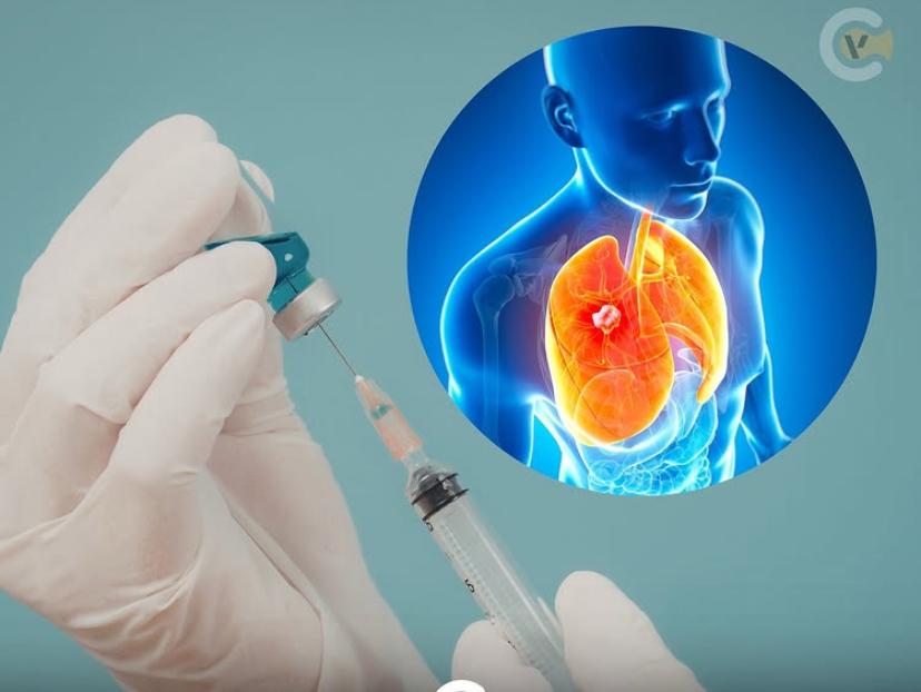 Vacina contra câncer de pulmão avança e começa testes em humanos