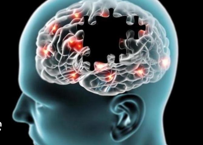 Pesquisa identifica relação entre alterações genéticas e doença de Alzheimer